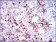 SPP1 Primary Antibody MP30443 [M7C5H12]