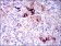 SPP1 Primary Antibody MP30443 [M7C5H12]
