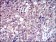SLC2A4 Primary Antibody MP30445A [M3G10A3]