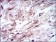 SLC2A4 Primary Antibody MP30445A [M3G10A3]