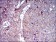 SLC2A4 Primary Antibody MP30445P [M3G10A3]
