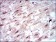 SLC2A4 Primary Antibody MP30445P [M3G10A3]