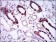 BMPR1A Primary Antibody MP30446P  [M4B7B2]