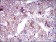 SLC27A5 Primary Antibody MP30454A [M4B11C10]