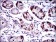 SLC27A5 Primary Antibody MP30454A [M4B11C10]