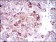 SLC27A5 Primary Antibody MP30454P  [M4B11C10]