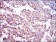 SLC27A5 Primary Antibody MP30455A [M9C4D1]