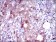 SLC27A5 Primary Antibody MP30455A [M9C4D1]