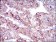 SLC27A5 Primary Antibody MP30455P  [M9C4D1]