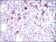 SLC27A5 Primary Antibody MP30455P  [M9C4D1]