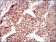 MAP1LC3A Primary Antibody MP30457A  [M5B10D8]