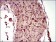 MAP1LC3A Primary Antibody MP30457A  [M5B10D8]