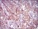DCTN4 Primary Antibody MP30469A  [M3G9D7]