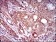DCTN4 Primary Antibody  MP30469P [M3G9D7]