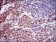 CLGN Primary Antibody  MP30473P [M9C8G10]