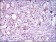 ITGA2B Primary Antibody MP30485A  [M2E10C9]