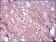 EGFR mutant Primary Antibody MP30486A [M5G9B5]
