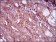 EGFR mutant Primary Antibody MP30486P [M5G9B5]