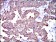 CK5 Primary Antibody MP30496 [M2C2B4]