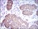 CK5 Primary Antibody MP30496 [M2C2B4]