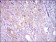SQSTM1 Primary Antibody MP30497 [M5H7E2]