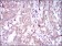 SQSTM1 Primary Antibody MP30497 [M5H7E2]