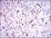 NPC1 Primary Antibody MP30501 [M8D10G3]