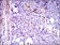 NPC1 Primary Antibody MP30501 [M8D10G3]