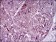 MCAM Primary Antibody MP30505 [M6C3E6]