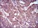 ZFP42 Primary Antibody MP30510 [M5E11E7]