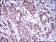 ALCAM Primary Antibody  MP30512 [M8E12C7]