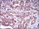 ABCG5 Primary Antibody MP30518 [M1B5E10]