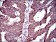 ABCG5 Primary Antibody MP30518 [M1B5E10]