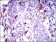 GPNMB Primary Antibody MP30520 [M7C10E5]