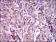 ABCC4 Primary Antibody MP30521 [M2D2A9]