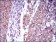 IL2RA Primary Antibody MP30522  [M1B5D12]