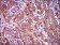 CLGN Primary Antibody  MP30523 [M1C8B6]