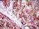 SLC27A2 Primary Antibody MP30525 [M6B3A9]