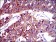 SLC27A2 Primary Antibody MP30525 [M6B3A9]