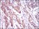 ABCC4 Primary Antibody MP30526 [M6A7H3]