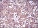 ABCC4 Primary Antibody MP30526 [M6A7H3]