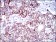 ALCAM Primary Antibody MP30528 [M4H9A5]
