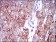ALCAM Primary Antibody MP30528 [M4H9A5]