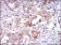 ONECUT3 Primary Antibody MP30533 [M7D4G10]