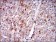 PLIN2 Primary Antibody MP30536 [M2C5A3]