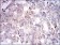PLIN2 Primary Antibody MP30536 [M2C5A3]