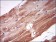 NPC1 Primary Antibody MP30538 [M8D10B6]