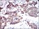 CK5 Primary Antibody MP30542 [M10C11E6]