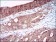 CA9 Primary Antibody MP30545 [M7C4A5]