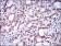 ZEB1 Primary Antibody MP30547 [M2A8A6]